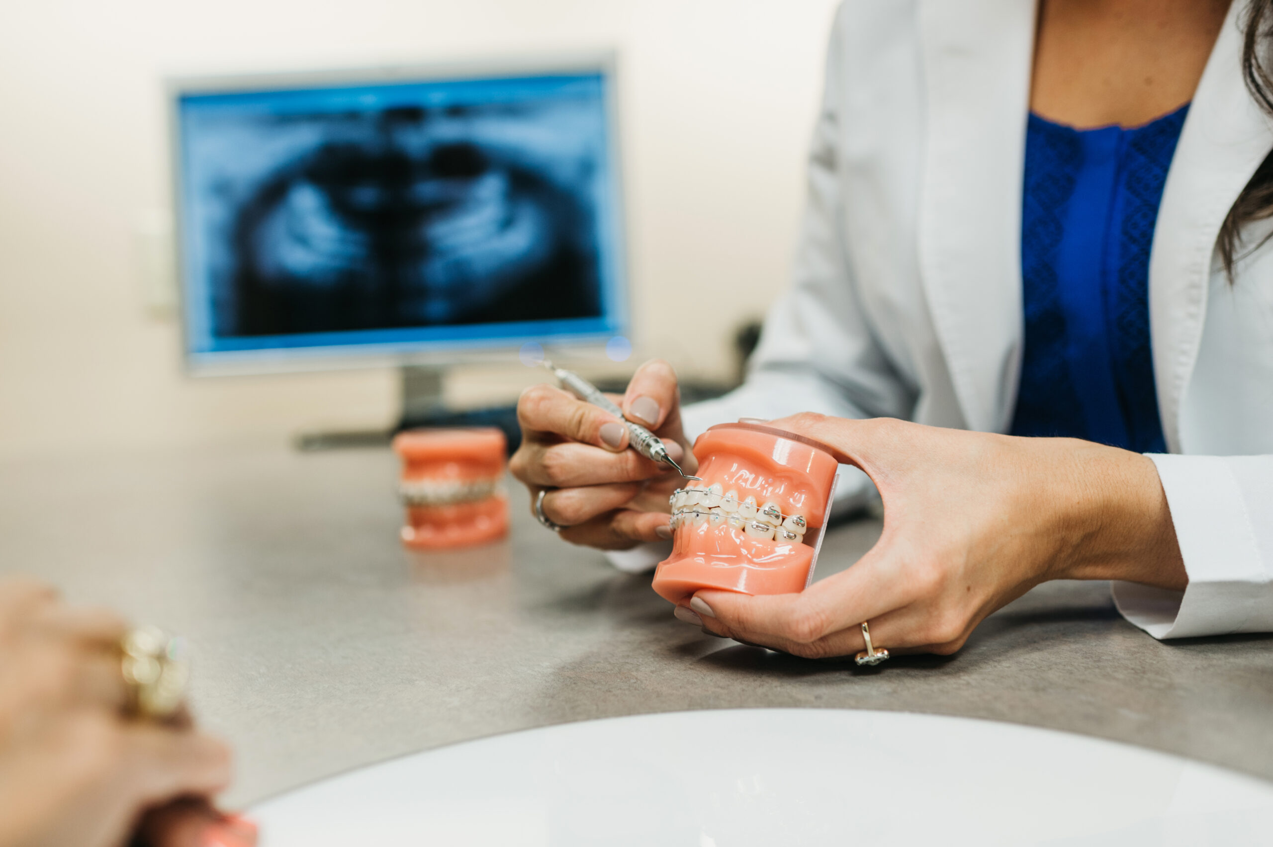 Affordable Traditional Braces Near Me: How to Find the Best Deals